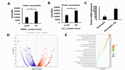 High-CD14-expressing urothelial cancer cells foster a neutrophil-rich tumor microenvironment that increases the risk of radiation-promoted distant metastasis